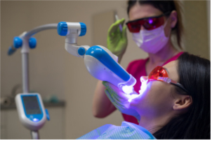 Laser teeth whitening