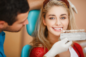 Composite Veneers