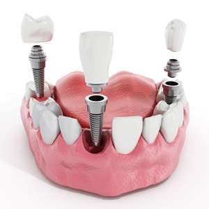 False Teeth