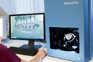 Dental Restorations