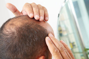 Hair transplantation