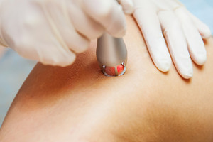 Reconstructive plastic surgery