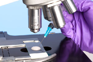 Frozen Embryo Transfer