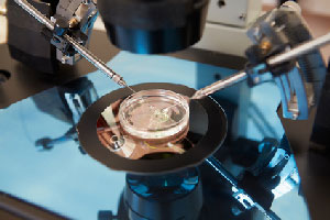 IVF procedure